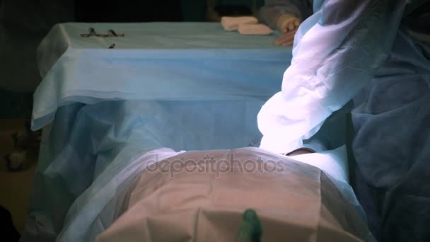操作を実行する男性外科医のクローズ アップ ショット。彼のアシスタントを拭くガーゼのパッドを使用して彼の額から汗の滴. - 映像、動画