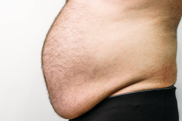 Tlustý muž s velkým břichem, osoby s nadváhou - Fotografie, Obrázek