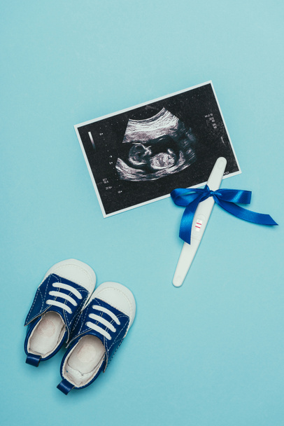 top view of arrangement of childish shoes, ultrasound scan and pregnancy test with ribbon isolated on blue - Fotografie, Obrázek