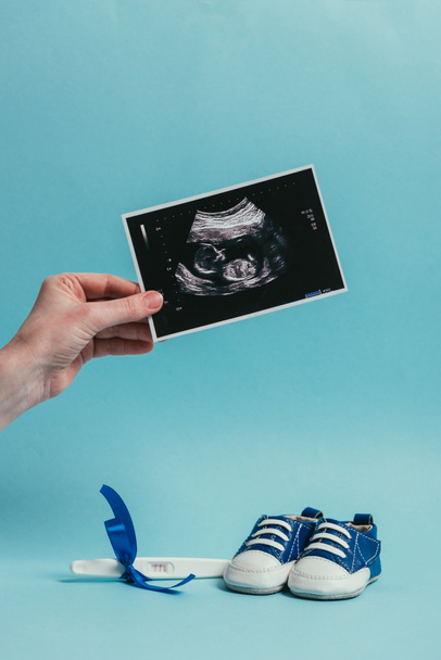 cropped shot of woman with ultrasound scan in hand, childish shoes and pregnancy test with ribbon isolated on blue - Foto, afbeelding