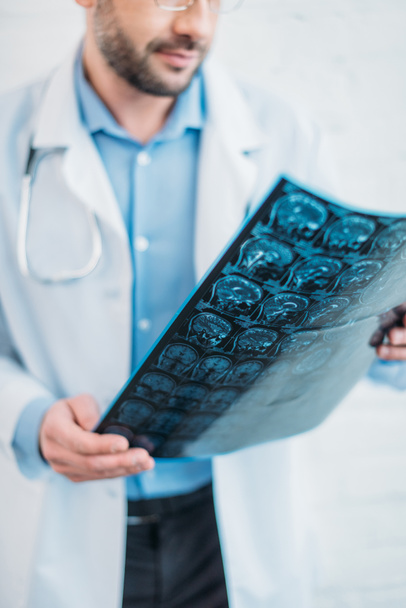 обрезанный снимок доктора, осматривающего МРТ
 - Фото, изображение