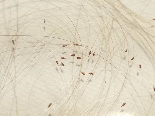Head lice (louses) isolated - Foto, Bild