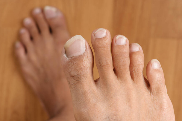 mannelijke voet - Foto, afbeelding