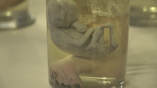 Anatomische menselijke specimens in formaline - Video