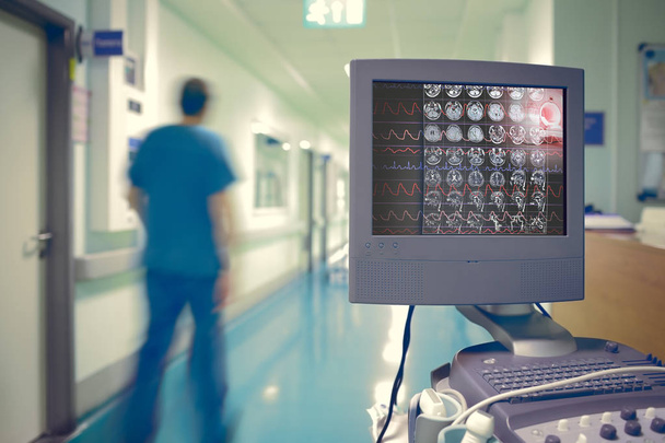 Medische monitor met Ecg en hersenen scannen op de achtergrond van blu - Foto, afbeelding