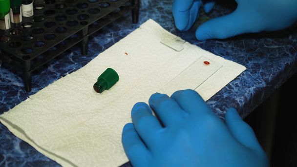 研究室では、血液サンプルの分析 - 写真・画像