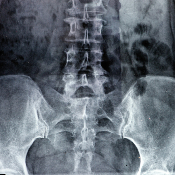Radiografías
 - Foto, imagen