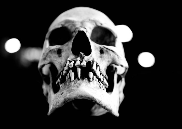 Fibra de vidro crânio humano dentes ausentes em um fundo preto
 - Foto, Imagem