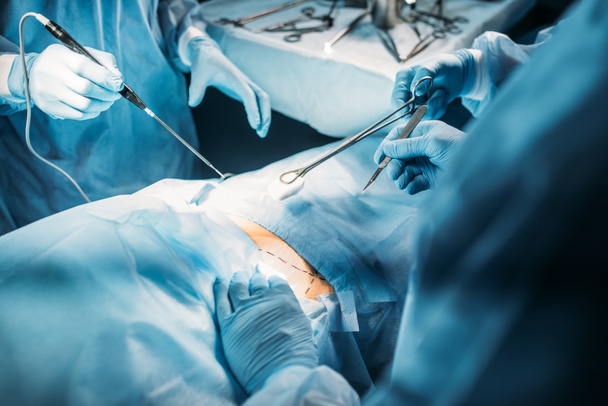 imagen recortada de cirujanos operando al paciente en la sala de cirugía
 - Foto, Imagen