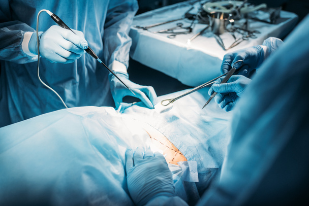 przycięte zdjęcie chirurgów operujących pacjenta na sali operacyjnej - Zdjęcie, obraz