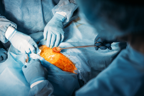imagen recortada de los cirujanos que operan paciente
 - Foto, Imagen