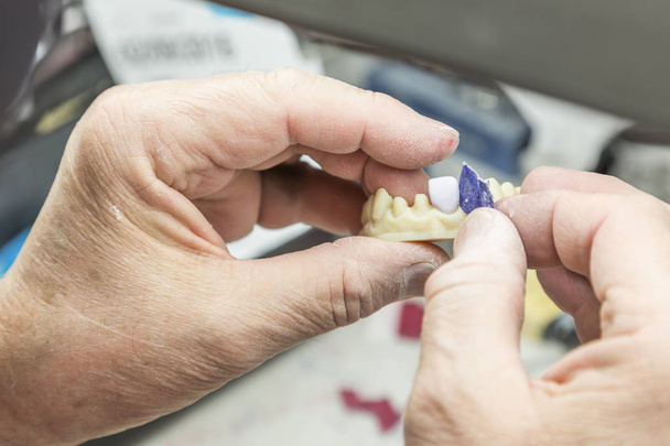 Odontotecnico che lavora su stampi stampati in 3D per impianti dentali
 - Foto, immagini
