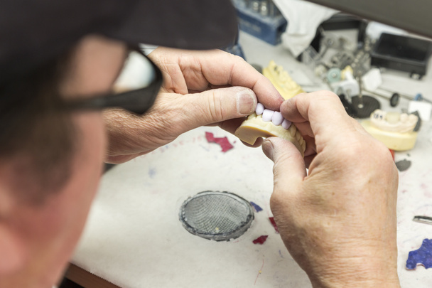 Зубной техник, работающий над 3D-печатью для зубных имплантатов
 - Фото, изображение