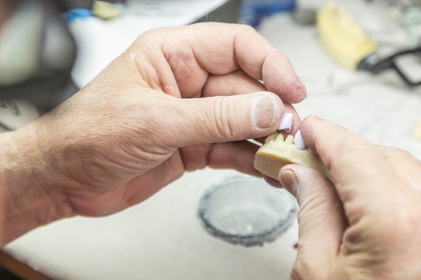 Zahntechniker arbeitet an 3D-gedruckter Form für Zahnimplantate - Foto, Bild
