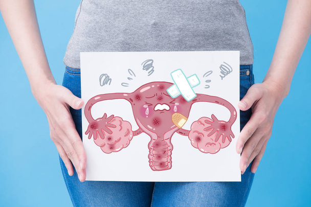 woman take unhealthy  uterus billboard on the blue background - Foto, Imagen