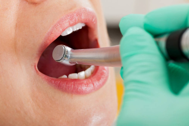 Zahnbehandlung hautnah - Foto, Bild