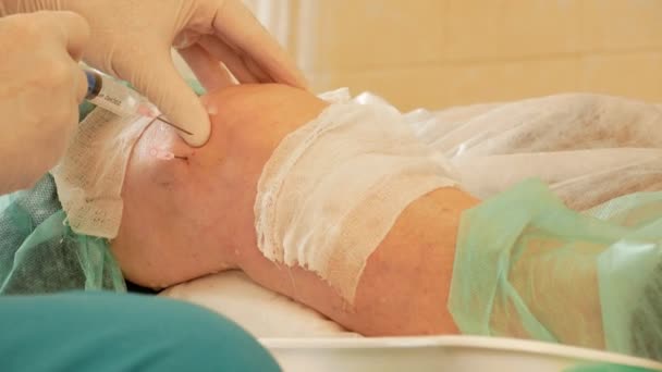 Медицинская операция на колене - врач высасывает жидкость из колена пациента шприцем
 - Кадры, видео