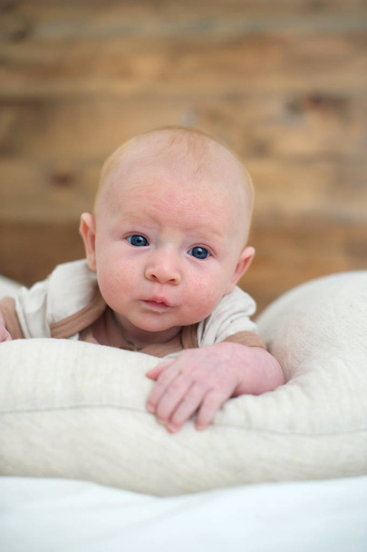 Newborn with a rash on the face - Foto, Bild