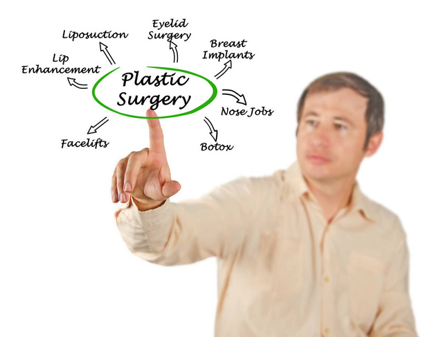 Diagram van plastische chirurgie - Foto, afbeelding