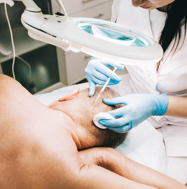el médico-cosmetólogo hace un procedimiento de cosmetología en la cabeza de un hombre para eliminar una marca de nacimiento, verrugas
 - Foto, Imagen