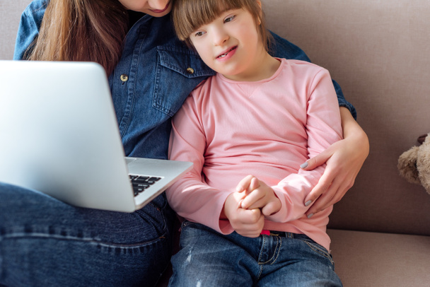 Mother and daughter with down syndrome using laptop - Photo, Image