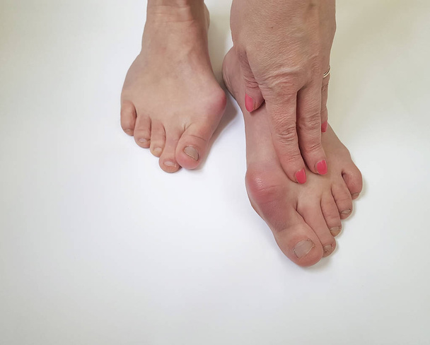koślawości nogi kobiece kobieta na białym tle - Zdjęcie, obraz
