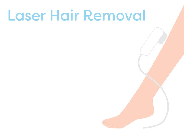 Tratamento cosmético da remoção do cabelo do laser - remoção do cabelo da perna
 - Vetor, Imagem