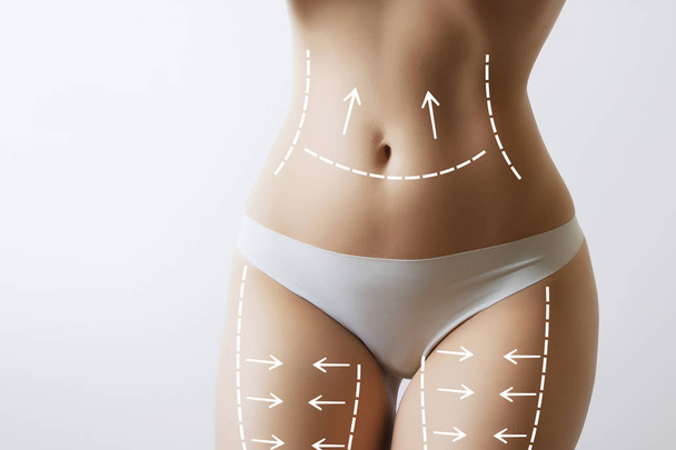 slim woman body with marks on stomach - Foto, Bild