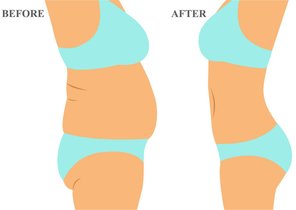 Healthy Lifestyle. Health. Before and after. - Vector, Image