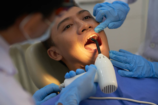 Dentista usando a cura lâmpada UV nos dentes do paciente
 - Foto, Imagem