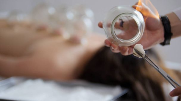 Lekarz ustawia Puchar wyroby ze szkła medyczne na odwrocie kobiety - Zdjęcie, obraz