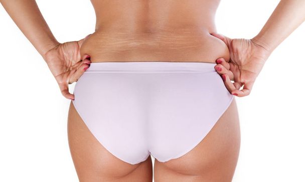 Woman fat body with cellulite and stretch marks on the back  - Zdjęcie, obraz
