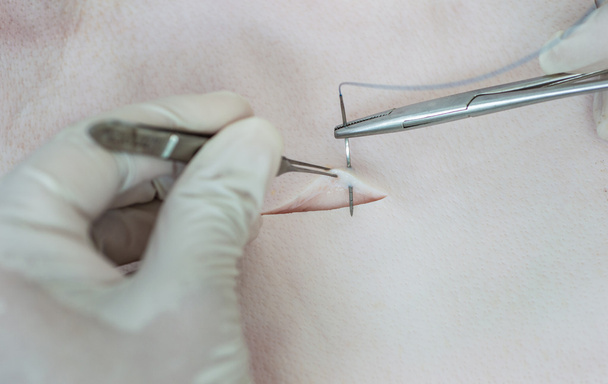 Pelle di sutura
 - Foto, immagini