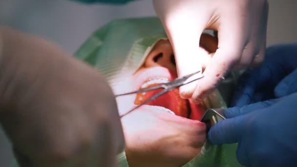 Médico dentista realiza um procedimento anestesia local durante cirurgia de estomatologia
 - Filmagem, Vídeo