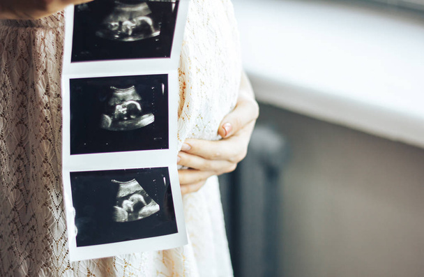 Chica embarazada sosteniendo fotos de ultrasonido resultado en las manos, cerca de la ventana con la luz del sol
 - Foto, Imagen
