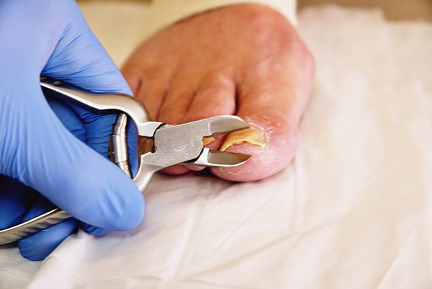 Close-up de uma manicure com alicate de pedicure cortando a unha da pessoa idosa
.  - Foto, Imagem