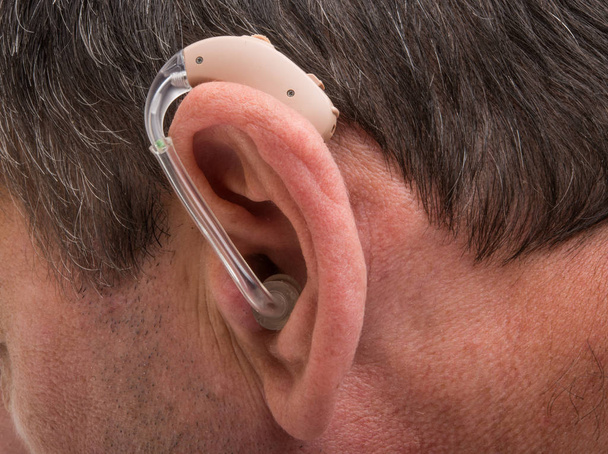 ヨーロッパの若者の耳にモダンな補聴器.  - 写真・画像