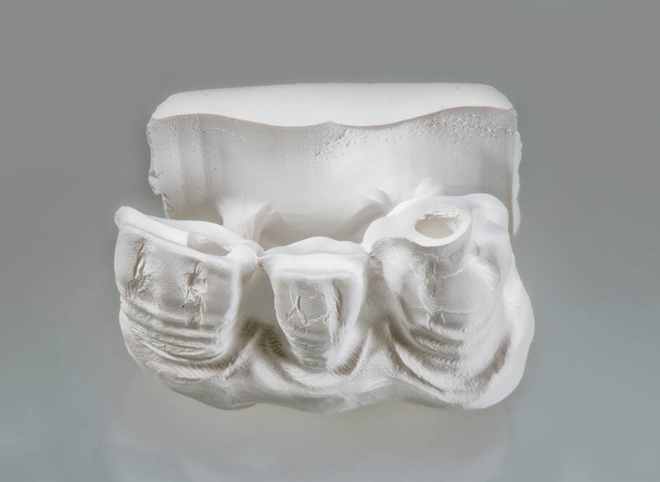 Technical shots of plaster model on a dental prothetic laborator - Fotó, kép