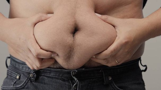 overweight man closeup of belly - Valokuva, kuva