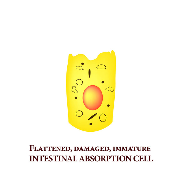 Structuur van de enterocyte. Misvormde, zieke cel. absorberend cellen de darm. Infographics. Vectorillustratie op geïsoleerde achtergrond. - Vector, afbeelding