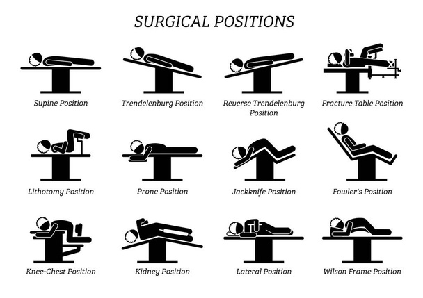 Operative Operationspositionen. Strichmännchen stellen eine Reihe von Operationspositionen für den Patienten auf dem Operationsstuhl und Bett dar. - Vektor, Bild