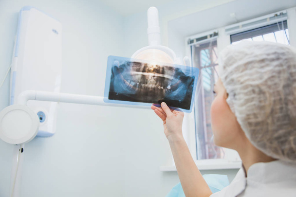 Female doctor dentist examining x-ray of human jaw - Fotografie, Obrázek