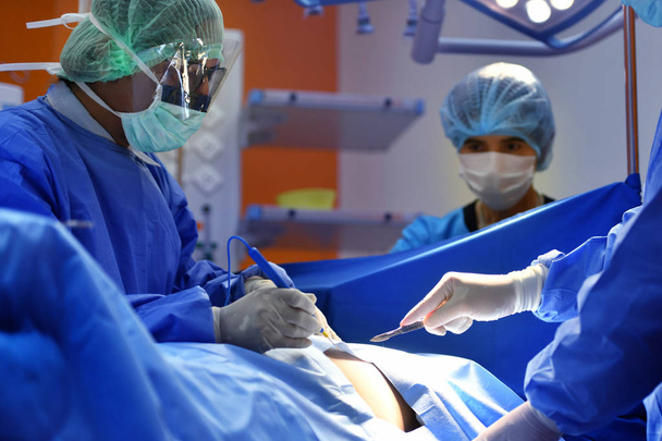 Cirujano de equipo trabajando en quirófano en hospital
 - Foto, Imagen