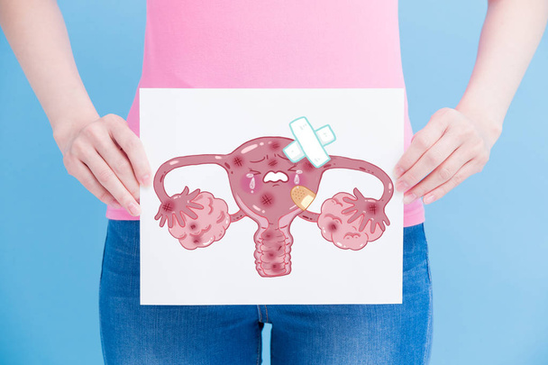 woman with  uterus billboard on the blue background - Valokuva, kuva