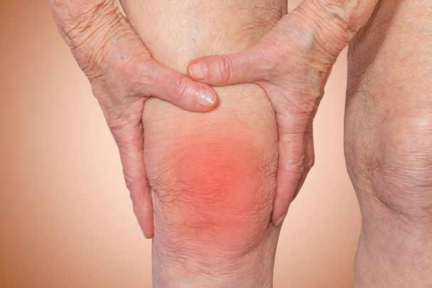 Femme âgée tenant le genou avec douleur
 - Photo, image