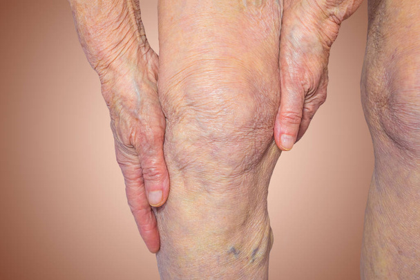 Mulher idosa segurando o joelho com dor
 - Foto, Imagem