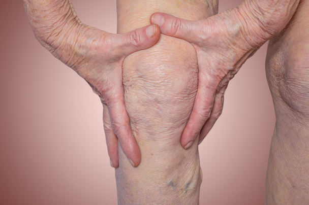 Ανώτερος γυναίκα κρατώντας το γόνατο με πόνο - Φωτογραφία, εικόνα