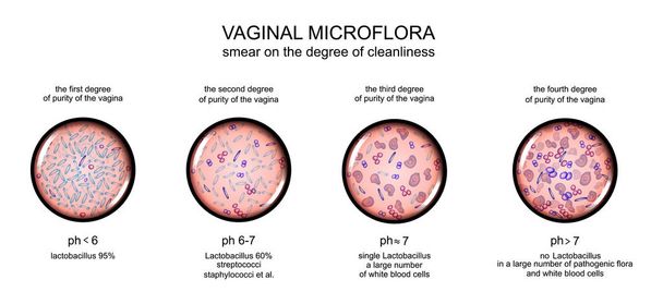 Microflora vaginal. grado de pureza de la vagina
 - Vector, imagen