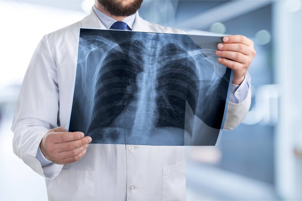 Doctor examining x-ray on blurred background  - Foto, Imagen