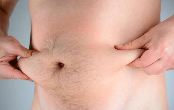 Overweight man squeeze fat on the waist. The problem of obesity. - Foto, imagen